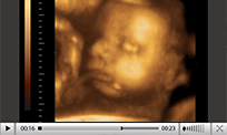 écho 3d ultrasons